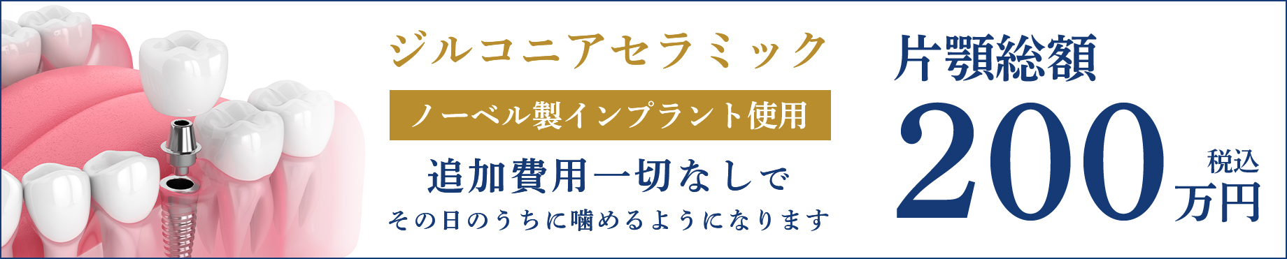 ジルコニアセラミック ノーベル製インプラント使用。追加費用一切なしでその日のうちに噛めるようになります。片顎総額200万円